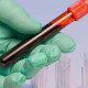 A new cancer treatment filters patients' blood to remove millions of white blood cells, alters them in the lab, and returns them to the patient.