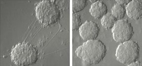 insulin-producing-cells