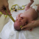 Dr. Vanessa Van Der Linden, the neuro-pediatrician who first recognized and alerted authorities over the microcephaly crisis in Brazil, measures the head of a 2-month-old baby with microcephaly in Recife, Brazil.