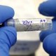 Development of Zika virus vaccine underway in India WHO
