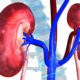 kidney disease