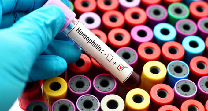 80% hemophilia cases undiagnosed in India: Doctors