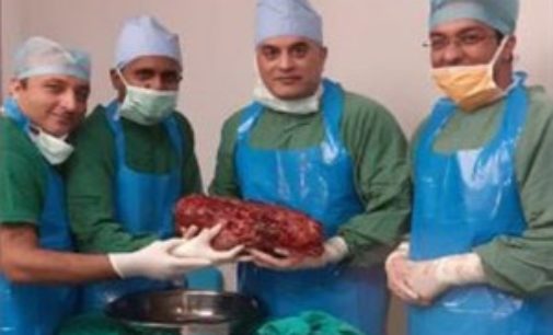 Doctors remove world’s largest kidney weighing 7.4 kg at Delhi hospital