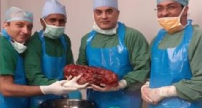 Doctors remove world’s largest kidney weighing 7.4 kg at Delhi hospital