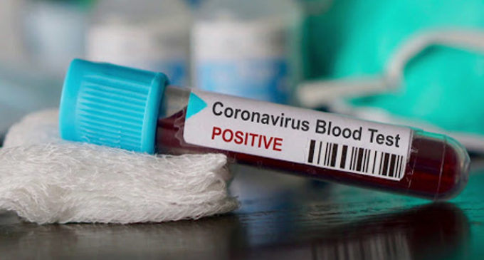 COVID-19: Total tally in India mounts to 1,06,750, death toll 3,303