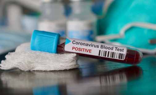 ICMR suggests states/UTs to reduce corona testing prices