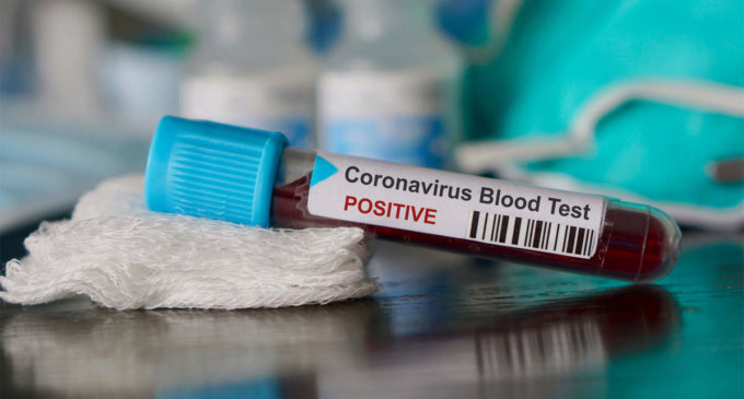 ICMR suggests states/UTs to reduce corona testing prices