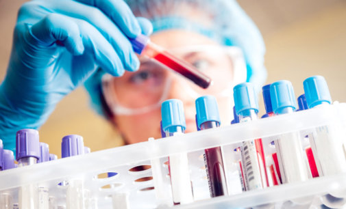 Aus university develops 20-minute COVID-19 blood test