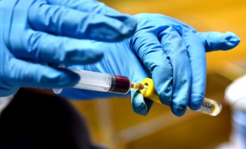This new test to diagnose Covid-19 in just 20 minutes