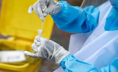 With spike of 81,484 cases, India’s COVID-19 tally reaches 63,94,069