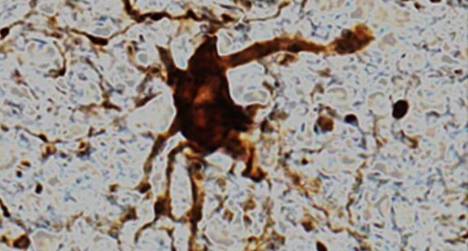 Research shows some genes come to life in the brain after death