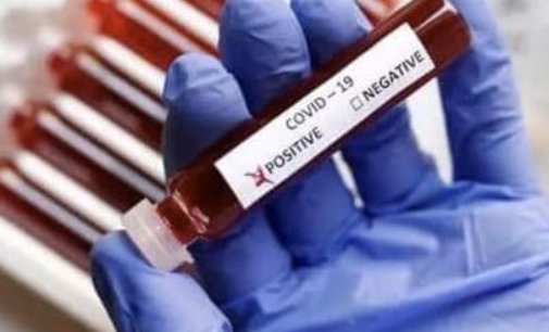 COVID-19: Detected across 30 countries, Lambda variant ‘deadlier’ than Delta