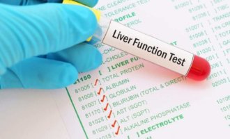 Monitor Your Liver Health with Regular SGPT Blood Test Monitor Your Liver Health with Regular SGPT Blood Test
