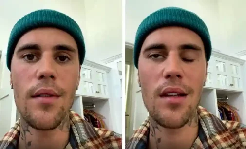 Half of Justin Beiber’s face paralysed by serious virus, cancels shows