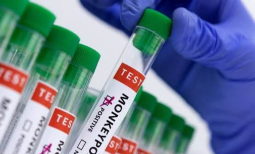 One youth dies with Monkeypox-like symptoms, Kerala health dept initiates inquiry